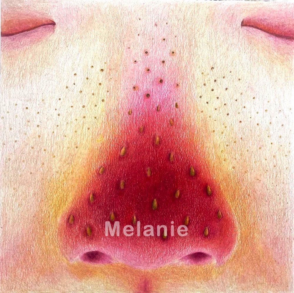 Fruit Skin 2